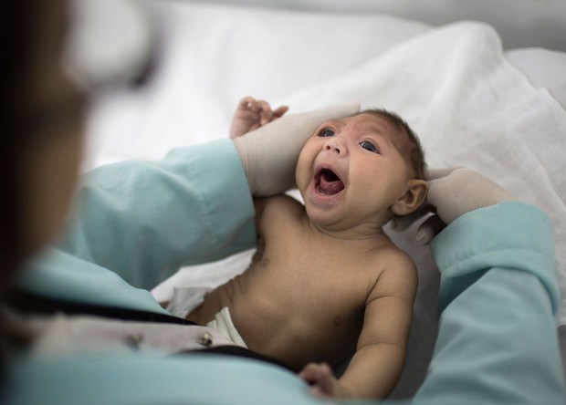 Das 1.829 notificações de bebês com suspeita de microcefalia em Pernambuco, foram confirmados 273 casos entre 1º de agosto do ano passado até 26 de março deste ano (Foto: Felipe Dana/AP)
